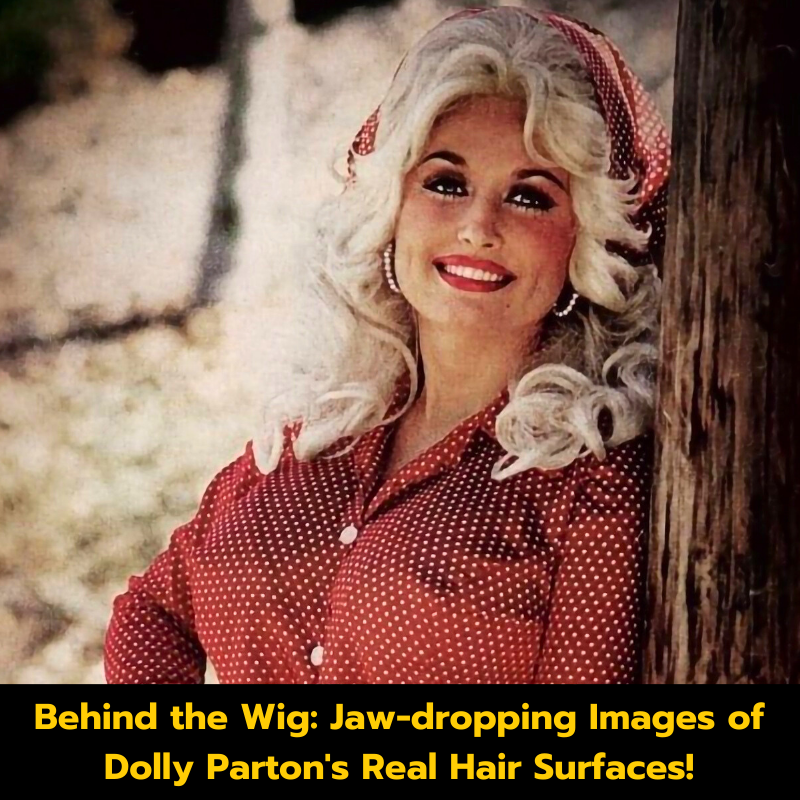 Behind the Wig: Jaw-dropping Images of Dolly Parton’s Real Hair Surfaces!