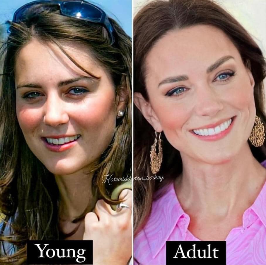 Kate Middleton’s Long-Hidden Secret Revealed: The Shocking Truth Unveiled